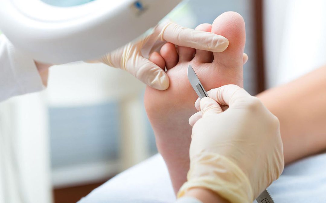 Diferencias entre Quiropodia y Pedicura